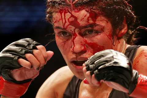 UFC star Julianna Pena rushed to hospital after losing ‘big chunk’ of her head in horrific injury..