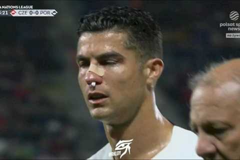 Cristiano Ronaldo left bruised and bloodied after sickening collision in Portugal match