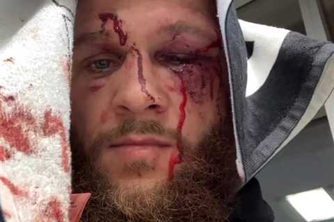 ‘We’re born for this’ – UFC star Rafael Fiziev shows off bloodied and battered face after war with..