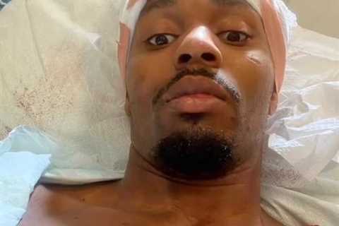 UFC star Lerone Murphy shares graphic pic of himself ‘almost bleeding out’ with horror head injury..