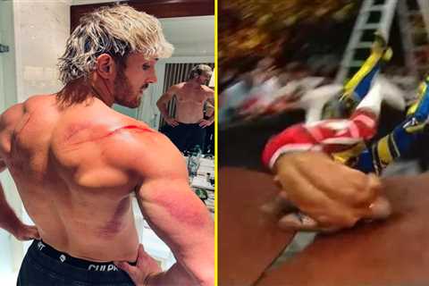 Logan Paul shows off bloodied body after being thrown through two tables during Money in the Bank..