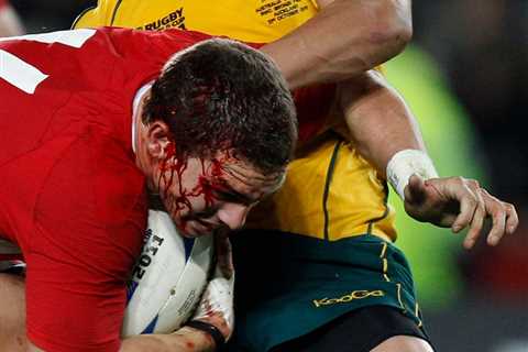 NFL-style lawsuit and brain-injury concerns hang over Rugby World Cup