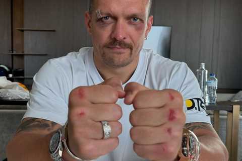 Oleksandr Usyk reveals injuries after Tyson Fury fight - Two black eyes and bruised knuckles on..