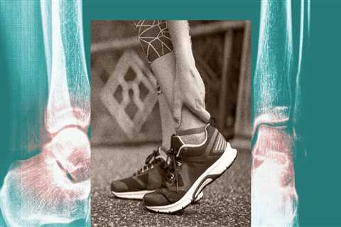 Understanding Common Injuries in Auto Racing Events